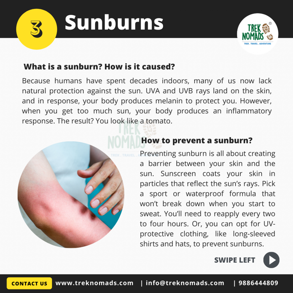 Preveting trekking injuries - Sunburn
